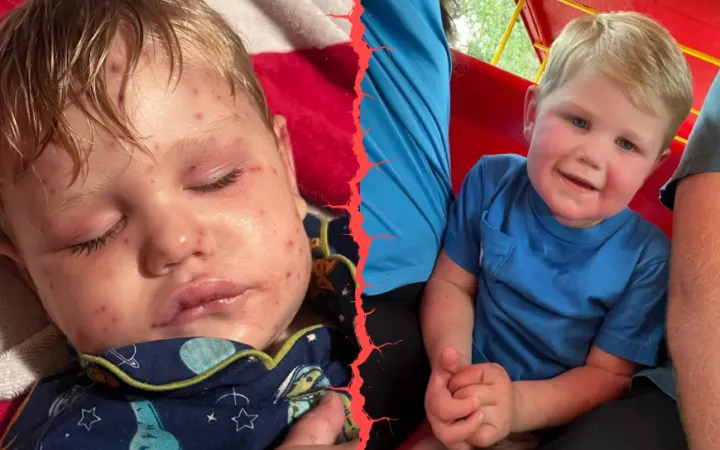 A Georgia Toddler Was Stung 150 Times by Wasps… How Did This Georgia Boy Survive Such a Horrifying Ordeal?