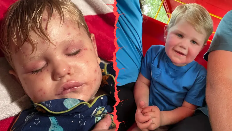 A Georgia Toddler Was Stung 150 Times by Wasps… How Did This Georgia Boy Survive Such a Horrifying Ordeal?