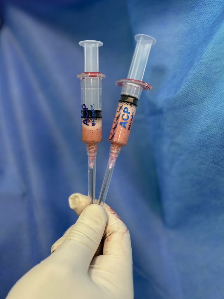 Gloved hand holding syringes against a blue background