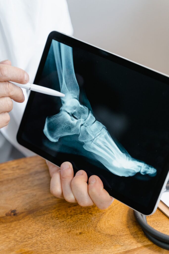Doctor pointing at an X-ray image on a tablet screen